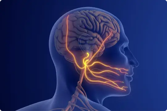 radioterapia funcional - Neuralgia del trigémino